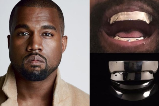 Kanye West's Bold New Dental Transformation: Titanium Dentures
