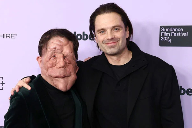 Sebastian Stan Voices Concern Over Insensitive Remarks at Berlin Film Festival
